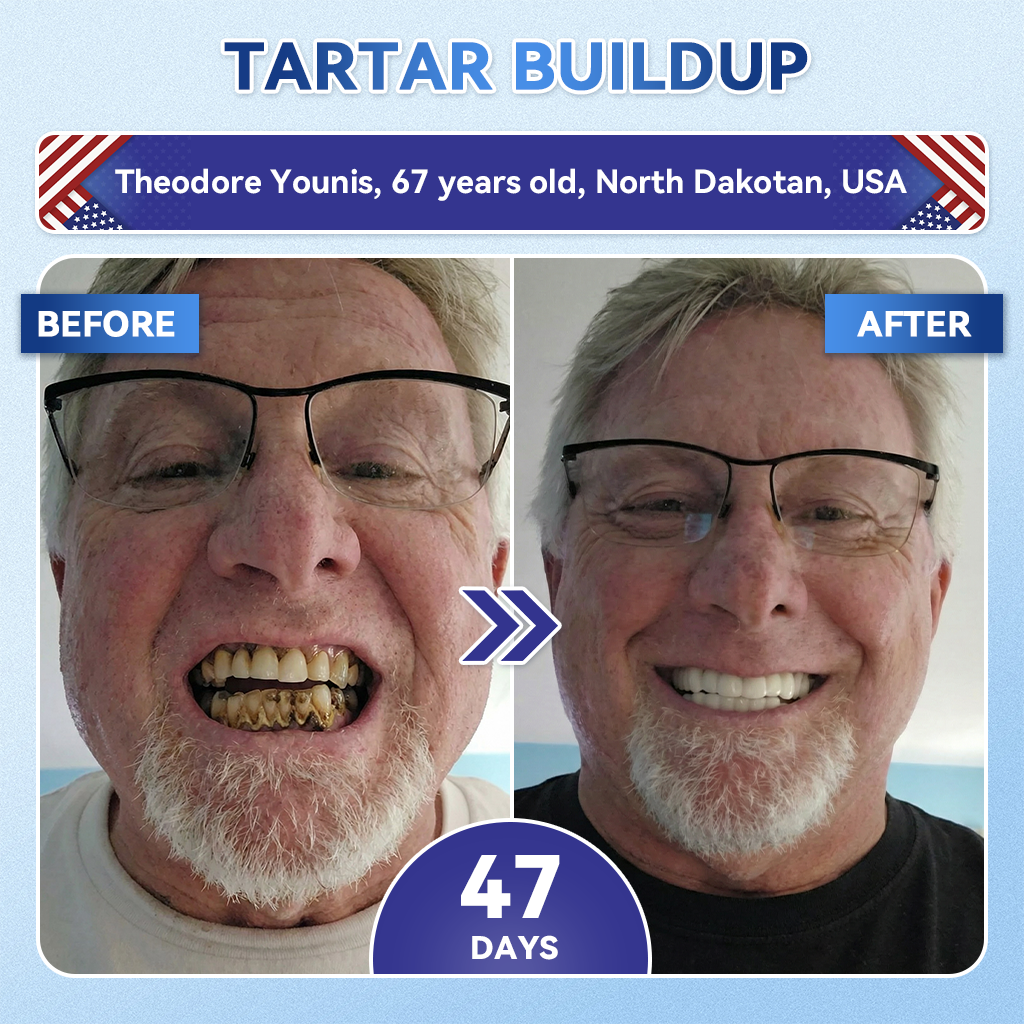 ZUEET® 🦷 Tideglusib Fast‑Dissolving Tooth & Gum Repair Oral Strips ✨ (Supports tooth repair and helps relieve gum discomfort and other common oral concerns)