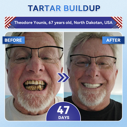 ZUEET® 🦷 Tideglusib Fast‑Dissolving Tooth & Gum Repair Oral Strips ✨ (Supports tooth repair and helps relieve gum discomfort and other common oral concerns)