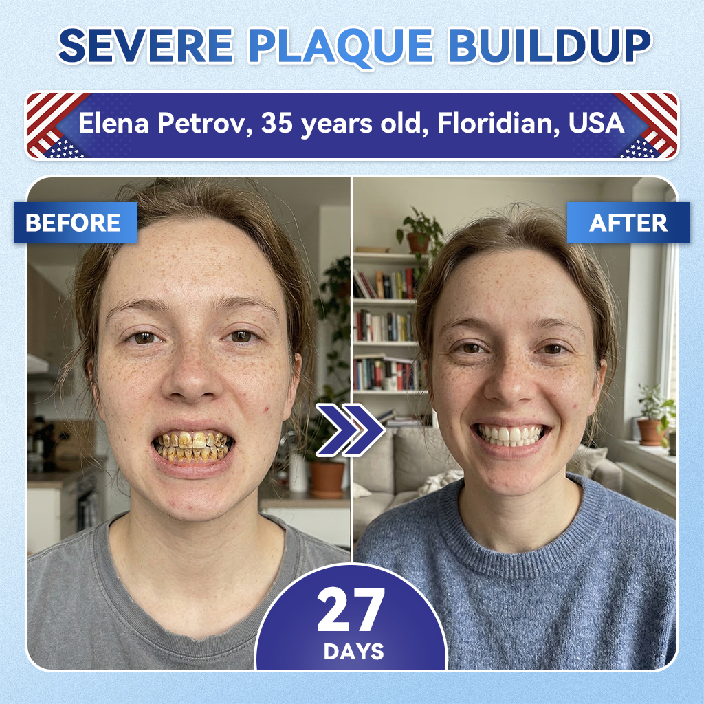ZUEET® 🦷 Tideglusib Fast‑Dissolving Tooth & Gum Repair Oral Strips ✨ (Supports tooth repair and helps relieve gum discomfort and other common oral concerns)