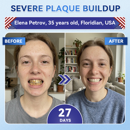 ZUEET® 🦷 Tideglusib Fast‑Dissolving Tooth & Gum Repair Oral Strips ✨ (Supports tooth repair and helps relieve gum discomfort and other common oral concerns)