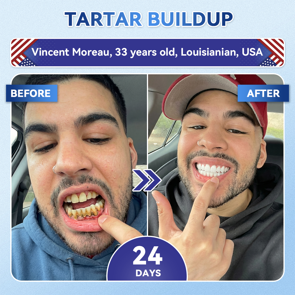 ZUEET® 🦷 Tideglusib Fast‑Dissolving Tooth & Gum Repair Oral Strips ✨ (Supports tooth repair and helps relieve gum discomfort and other common oral concerns)