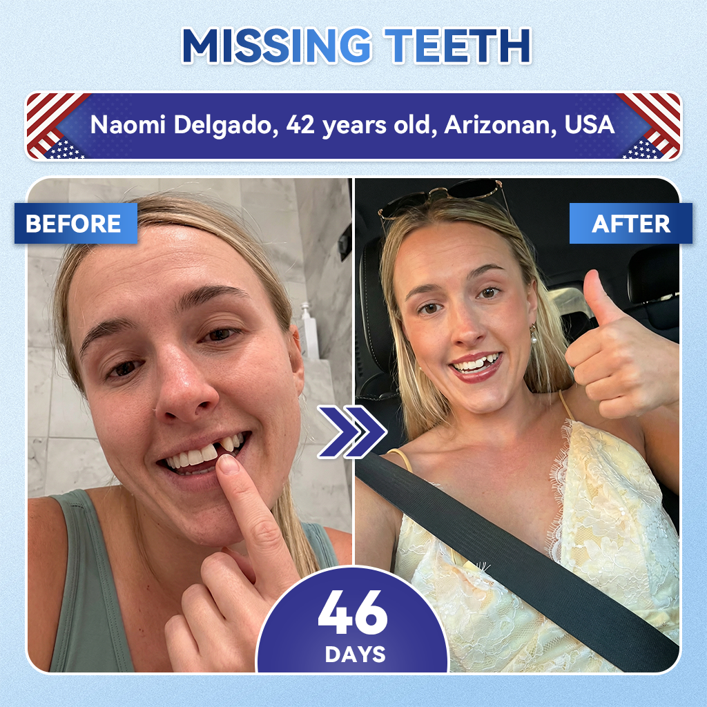 ZUEET® 🦷 Tideglusib Fast‑Dissolving Tooth & Gum Repair Oral Strips ✨ (Supports tooth repair and helps relieve gum discomfort and other common oral concerns)