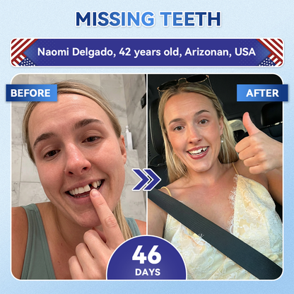 ZUEET® 🦷 Tideglusib Fast‑Dissolving Tooth & Gum Repair Oral Strips ✨ (Supports tooth repair and helps relieve gum discomfort and other common oral concerns)