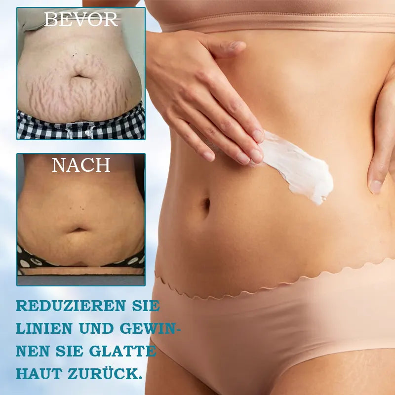 ✨ Reveal Radiant Skin After the Weight Comes Off – Try Our Firming & Smoothing Cream Today!